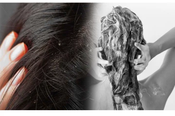 குளிர்காலத்தில் ஏற்படும் பொடுகு அரிப்பை தடுக்கவேண்டுமா?