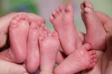 யாழ் போதனா வைத்தியசாலையில் அரிய சம்பவம் ; ஒரே பிரசவத்தில் நான்கு குழந்தைகளை பெற்ற தாய்