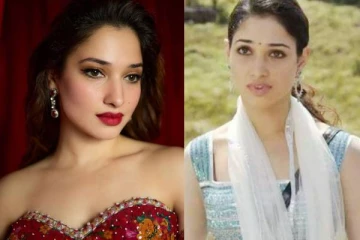 நடிகை தமன்னா இப்படி அழகாக மாற இந்த சர்ஜரி தான் காரணம்!! ஆனால் பாதிப்பு...