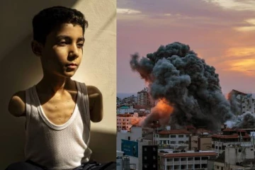 இரு கைகளையும் இழந்த 9 வயது காஸா சிறுவன்! மனதை உலுக்கும் புகைப்படம்..World Press Photo ஆக தெரிவு