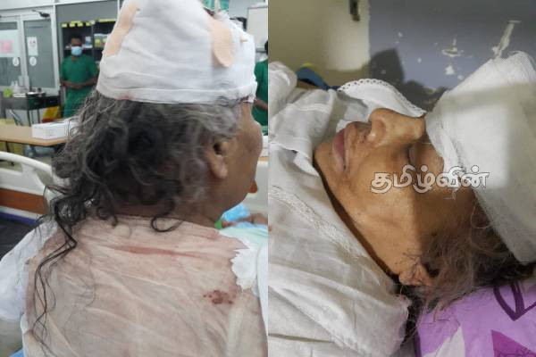 வயோதிப பெண்ணை தாக்கி நகைகள் திருட்டு:பொலிஸார் தீவிர விசாரணை(Photo) | Attack Elderly Woman And Steal Jewelry