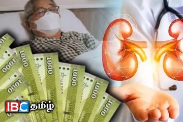 சிறுநீரக நோயாளர்களுக்கான கொடுப்பனவு : வெளியான தகவல்