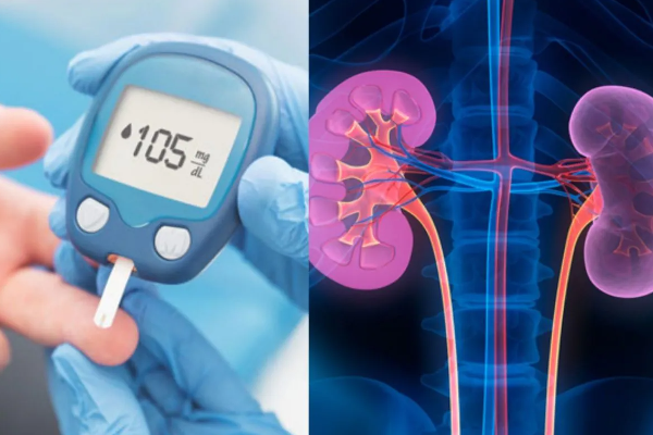 வடபகுதியில் நீரிழிவு நோயின் தாக்கம் அதிகரிப்பு | Increasing Incidence Of Diabetes In The North