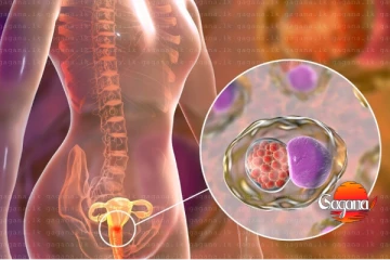 කාන්තාවන්ට මාරාන්තික රෝගයක් - දැන්ම පරික්ෂා කරගන්න