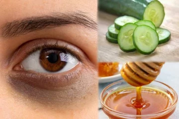 ஒரே வாரத்தில் கருவளையம் நிரந்தரமாக நீங்க இந்த இரண்டு பொருட்கள் போதும்