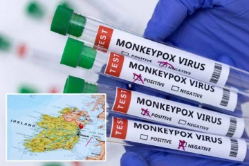 முதல் குரங்கம்மை நோய் தொற்றை உறுதிபடுத்தியது அயர்லாந்து: தடுப்பு நடவடிக்கை தீவிரம்!