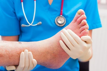 ජීවිතය අවදානමේ දාන සෙලියුලයිටීස්.