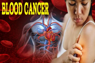 Blood Cancer Symptoms: இளைஞர்களை குறிவைக்கும் இரத்த புற்றுநோயின் அறிகுறிகள் என்ன?