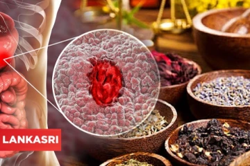 குடல் புண்ணால் அவதிப்படுபவர்களுக்கு இதோ சூப்பரான அற்புத இயற்கை மருத்துவம்!