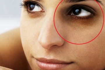 கருவளையம் நிரந்தரமாக நீங்க வேண்டுமா? இதை மட்டும் செய்யுங்கள்