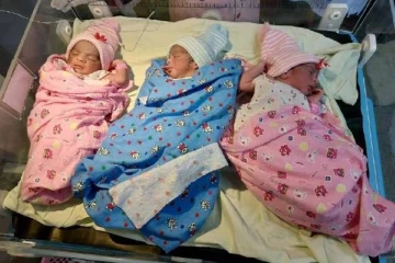 யாழில் ஒரே பிரசவத்தில் மூன்று பிள்ளைகள் (படங்கள்)