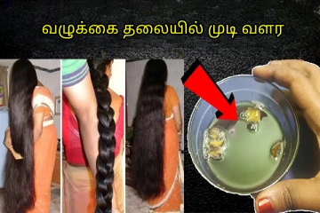 வழுக்கை தலையிலும் முடி வளரணுமா? கடுகு எண்ணெய்யில் இந்த பொருளை கலந்தால் போதும்