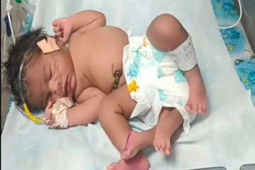 4 கால்களுடன் பிறந்த அதிசய குழந்தை! ஆச்சரியத்தை ஏற்படுத்தியுள்ள சம்பவம்