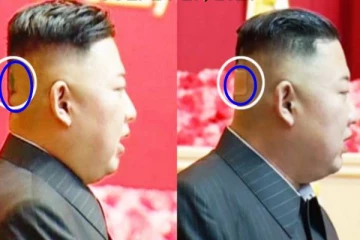 வடகொரிய அதிபரின் உடல்நிலை குறித்து  கிளம்பிய சர்ச்சை!