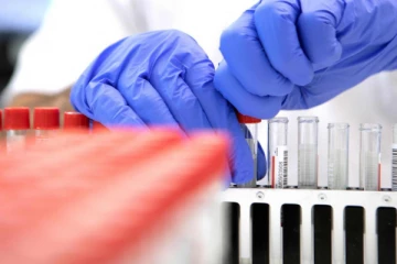 கோவிட் பாதிப்புக்குப் பின்னர் அதிகரித்து வரும் நோய்கள் குறித்து அப்போலோ வைத்தியர்கள் தகவல்!