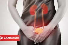 இந்த அறிகுறி இருக்கா? அப்போ உங்களுக்கு சிறுநீர் தொற்றாக இருக்குமாம்