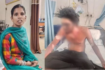 தகாத உறவு: காதலன் மீது கொதிக்கும் எண்னெயை ஊற்றிய திருமணமான பெண் - நடந்தது என்ன?