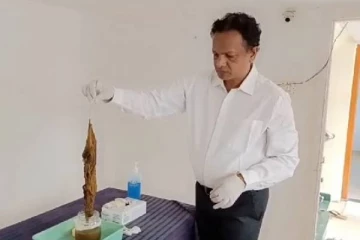 பிரசவத்தின் போது வயிற்றில் துணிவைத்து தைத்த மருத்துவர்கள்! 3 மாதங்களுக்கு பிறகு நடந்தது என்ன?