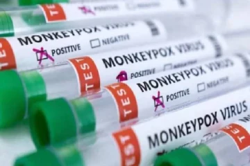 டெல்லிக்கும் பரவியது குரங்கு அம்மை : அதிர்ச்சியில் பொதுமக்கள்