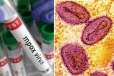 பிரித்தானியாவில் கூடுதலாக 2 Mpox வைரஸ் நோயாளிகள்: அறிகுறிகள், பரவும் விதம் என்னென்ன?