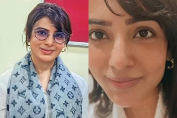 அரியவகை நோயால் நடக்கமுடியாத நிலை!! சிகிச்சைக்கு பின் நடிகை சமந்தா செய்த செயல்..