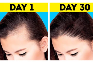 முடி அதிகம் கொட்டுதா? ஷாம்புவுடன் இதை கலந்தால் போதும்- கிடுகிடுவென வளரும்