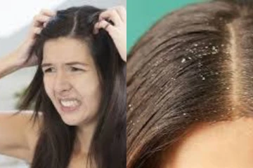 හිස්සොරි නම් ඇත්තටම කරදරයක්.. කොහොමද මිදෙන්නේ ඔබත් අත්හදා බලන්න.