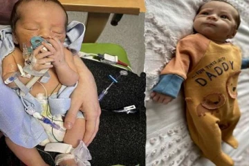 பிரித்தானியாவில் அரிய வகை பாதிப்புடன் பிறந்த குழந்தை!