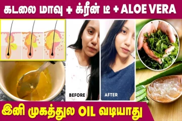 முகத்தில் உள்ள எண்ணெயை போக்க இத பூசி பாருங்க