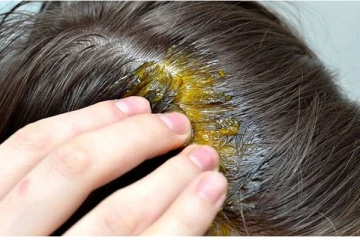 முடி கருகருவென அடர்த்தியா காடு மாதிரி வளரனுமா? இந்த சாற்றில் தலையை அலசுங்க போதும்!