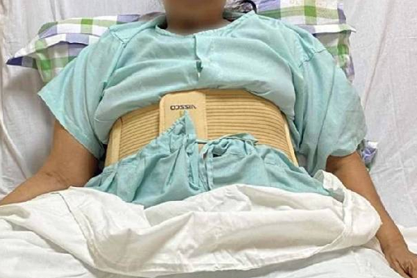 47 கிலோ கட்டியோடு 18 வருடம் வாழ்ந்து வந்த பெண்! இந்தியாவில் மருத்துவர்கள் படைத்த சாதனை | India Gujarat Treatment Doctor Achievement Surgery