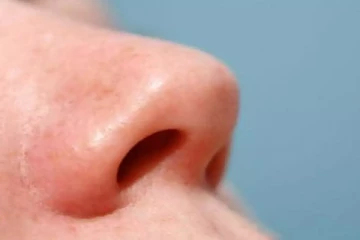 குடும்பத் தகராறில் மனைவியின் முக்கை அறுத்த கணவர்!