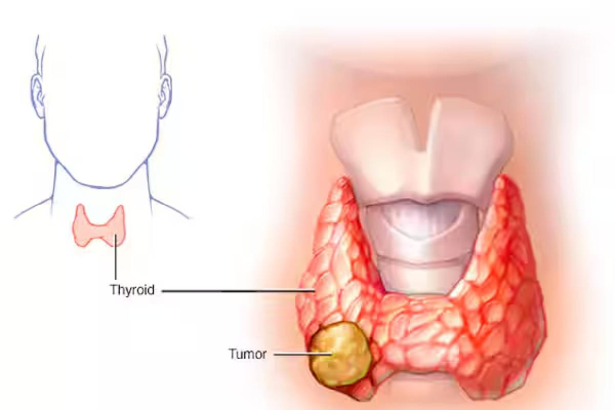 காலையில் வெறும் வயிற்றில் கொத்தமல்லித் தண்ணீர் குடிப்பதன் பயன் இவவளவா? | Benefits Of Drinking Coriander Seeds Water