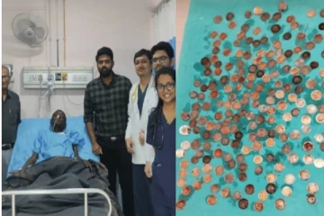 பிச்சைக்காரர் வயிற்றில் இருந்த 187 நாணயங்கள்! தினமும் சாப்பிட்டு மகிழ்ந்ததாக அதிர்ச்சி தகவல்