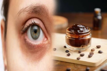 உங்களுக்கு கருவளையம் இருக்கா... இதை மட்டும் செய்யுங்கள் உடனே நீங்கிவிடும்