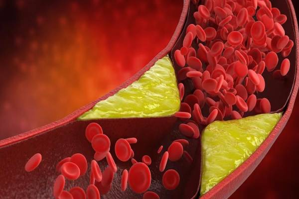 கொலஸ்ட்ரால் அதிகரிப்பதற்கான காரணங்கள் என்ன... எப்படி கட்டுப்படுத்துவது? | Reasons For High Cholesterol Level How To Control