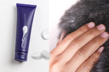 හිසරදය හදාගන්නේ නැතුව හිස්හොරි කරදරෙන් බේරෙන හොඳම ක්‍රම මෙන්න.