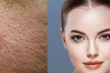 முகத்தில் ஏற்படும் சரும துளைகளை நீக்க வேண்டுமா? இதை மட்டும் பயன்படுத்துங்க