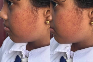 தவறான பதிலுக்கு தண்டனையா? மாணவியை அறைந்த ஆசிரியர் மீது பொலிஸில் முறைப்பாடு