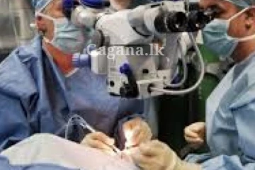 අක්ෂි කාච නොමිලේ ලබා ගත හැකියි - වැඩේ වෙන්නේ මෙහෙමයි..