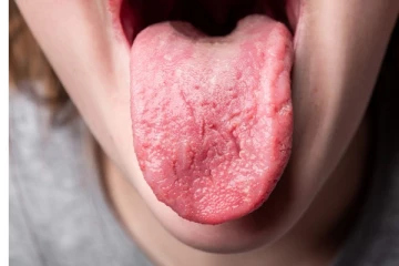 உங்க நாக்கு இப்படி இருக்கா? இந்த சத்து குறைபாடாக இருக்கலாம்