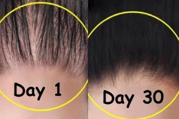 முடி கிடுகிடுன்னு அடர்த்தியா வளரனுமா? இந்த ஒரே ஒரு பொருளை தலையில் தடவி மசாஜ் செய்யுங்கள்