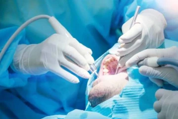 ஒரே நாளில் 23 பற்கள் பிடுங்கப்பட்ட நபர் பரிதாபமாக உயிரிழப்பு! அதிர்ச்சி சம்பவம்