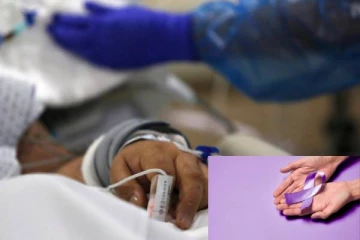 நாட்டில் அதிகரித்துள்ள தொழுநோய் தாக்கம்