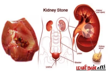 நீங்கள் சிறுநீர் கழிக்கும் போது இந்த அறிகுறிகள் இருக்கா? கவனமாக இருங்க