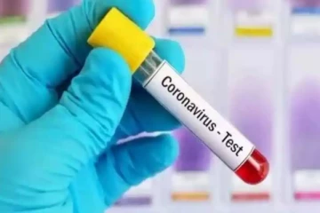 மேலும் 2720 பேருக்கு கொரோனா