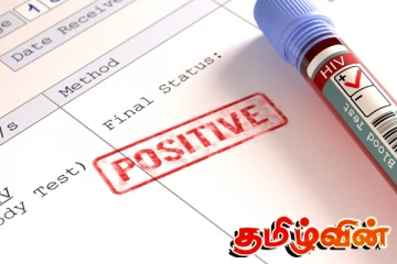 இலங்கையில் 15 முதல் 29 வயதுக்குட்பட்டவர்களிடையே எச்.ஐ.வி தொற்று அதிகரிப்பு