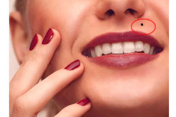 இந்த இடத்தில் மச்சம் இருந்தால் பெரும் அதி்ர்ஷ்டமாம்! பலருக்கும் தெரியாத சுவாரசியம் | Mole In Face And Body Place Very Lucky