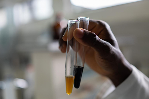 உலகம் முழுவதும் கொரோனா தொற்றாளர்களின் எண்ணிக்கை! | Number Of Infected People Worldwide