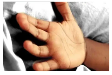 பெற்றோர்களின் அலட்சியம்: பரிதாபமாக உயிரிழந்த ஒன்றரை மாத குழந்தை